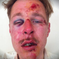 La cara de la homofobia en Francia