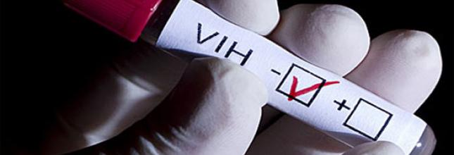 prueba-vih-sida-resultados