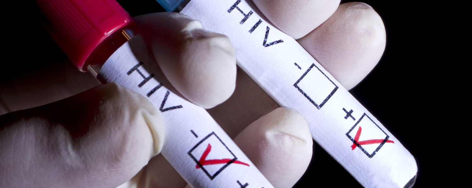 Desarrollan una prueba para detectar VIH oculto